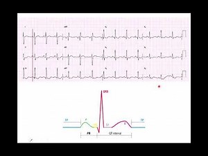 EKG Background and Biopac Tutorial