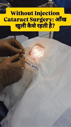 Without Injection Cataract Surgery: Eye बंद क्यों नहीं होता?