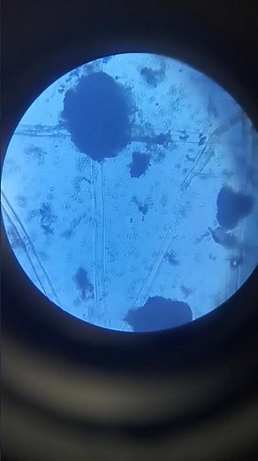 Aspergillus niger under microscope || LPCB wet mount#fungus