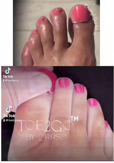 False Toenail Ring: Perfect Solution for Missing Toenails
