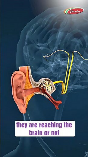BERA Test Explained | Detect Hearing & Nerve Problems Early | Chandan Diagnostics