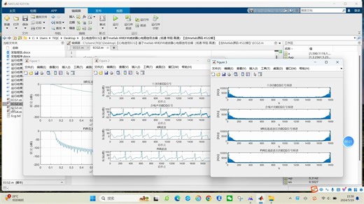 【心电信号ECG】基于matlab IIR和FIR滤波器心电图信号去噪（低通 带阻 高通）【含Matlab源码 4522期】