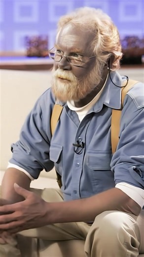 “He tried to cure his skin—and turned permanently blue.” Paul Karason’s transformation stunned the world 🌊😮 But few know the real story behind his condition. See the photos and learn what really happened in the comments 👇📸 | Interesting to know