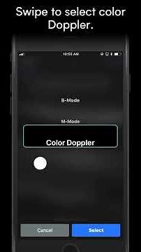 How To Scan in Color Doppler | Butterfly Network