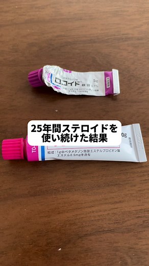 アトピー性皮膚炎の相談と対策方法