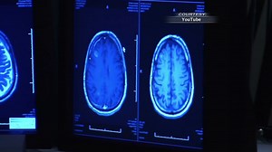 Expert discusses recognizing ADHD in adults, talks new treatment options - WBBJ TV