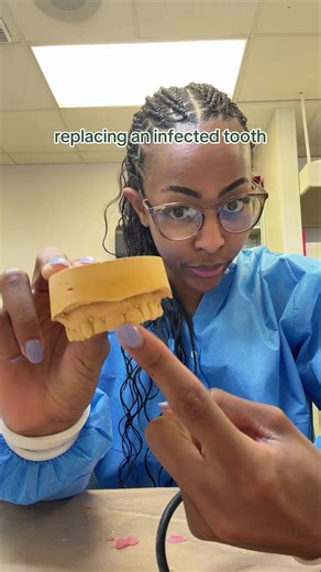 making a flipper in dental school #dentalstudent #dentalschool #dentist