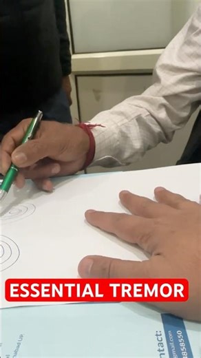 Essential Tremor - Tremor in action and postural #essentialtremor #neurologistindehradun #tremor