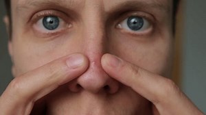 Young Man Closely Examines Red Pimple Stock Footage Video (100% Royalty-free) 3758284923 | Shutterstock