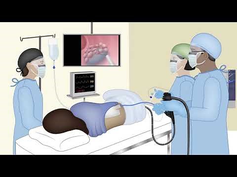 Colonoscopy: Hot Snare Polypectomy