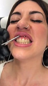 Smiley Piercing 💉🤭 to make you smile even more ❤️ #piercing #nailsart #lashextensions #lifting #beauty #beautiful #clean #painting #nailsart #fbreels #makeupartist #reelsinstagram #diy #viralpage #AmaZing #reelsfb #reels2024 #viralreels #tutorial #foryou #style #styleinspo | Piercing Pigs