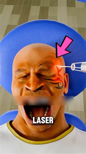 Why LASER TATTOO REMOVAL Doesn’t burn Ink away?⁉️😨