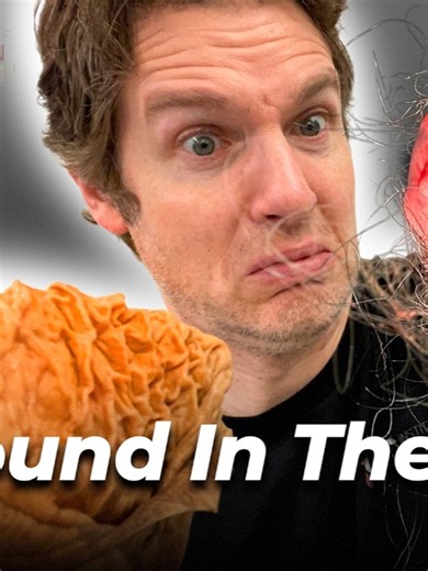 5 Shocking Things People Swallow (And What Happens)#anatomy #medicaleducation #humanbody