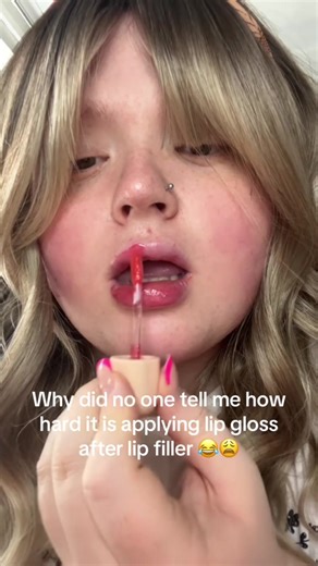 Enhance Your Look with Lip Fillers and Glosses