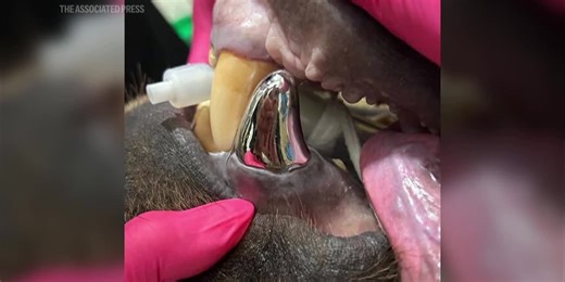 An Alaska brown bear has a new shiny smile after getting a huge metal crown for a canine tooth