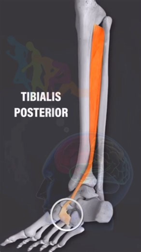 Advance Physiotherapy Rehabilitation Centre on Instagram: "**TIBIALIS POSTERIOR | FLEXIBLE FOOT | ECCENTRIC CONTRACTION** The tibialis posterior muscle plays a vital role in supporting the arch of the foot and maintaining proper alignment during walking and running. In a flexible flat foot, this muscle often becomes weak or overstressed, leading to pain, instability, and fatigue in the foot and ankle. Eccentric contraction exercises are especially important for strengthening the tibialis posteri