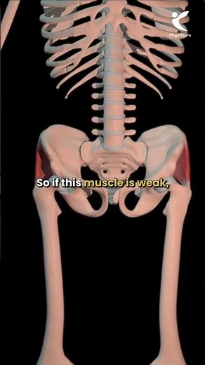 Hip Abductor Exercises for Sciatica #hipstrengthening #hipexercises #sciaticarelief #sciatica