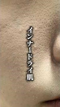 インナードライ肌の夜スキンケア紹介！