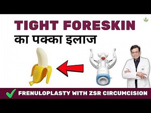 Frenuloplasty with ZSR Circumcision – Safe Solution for Skin Tightness & Better Intimacy