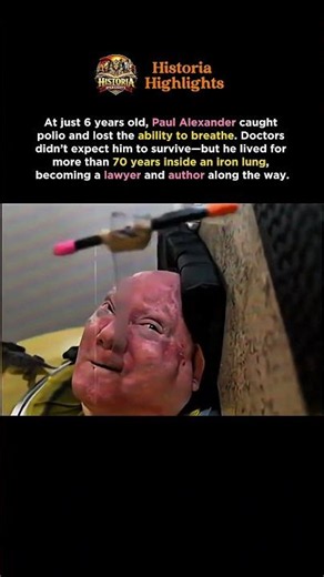 Doctors Thought He Wouldn’t Survive—He Lived 70 Years in an Iron Lung