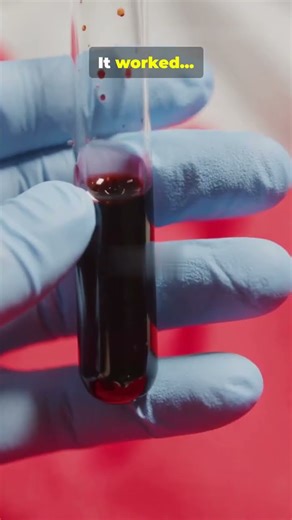 The Man Who Tried to Erase Death The Blood Experiment That Killed a Genius