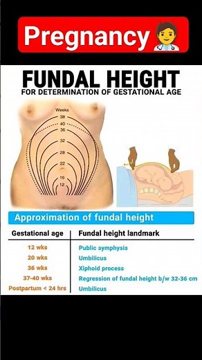 #fundal_height #fundal_height_measurements #gestational_age #fundal_height_landmark #pregnancy