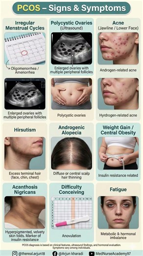 PCOS Explained | Signs & Symptoms of Polycystic Ovary Syndrome | Gynecology #medicalstudents