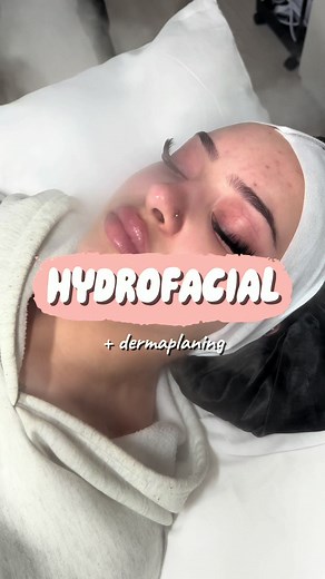 Deep Cleanse and Hydration for Dull Skin