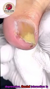 Gentle Solutions for Seniors to Enjoy Long-Term Foot Health 🪷🌸 #feetfirst #dailywellness #footcare | Bye