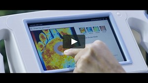 Introducing the HyperView Imaging System