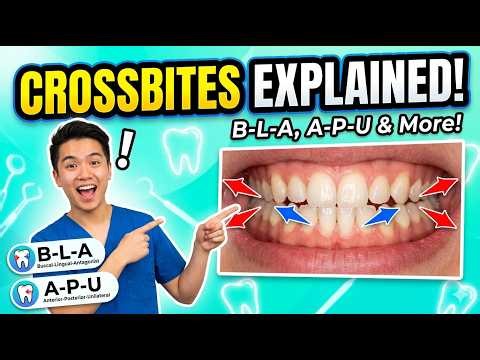 Crossbite Explained in 5 Minutes | Types, Causes, Features & Management (Orthodontics)