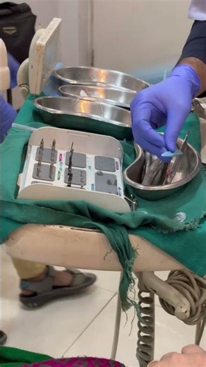 Immediate implant🦷 #trending #dentistry #dentist #minivlog #youtubeshorts