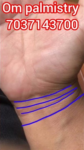 Is Palm Reading the Key to Good Health?