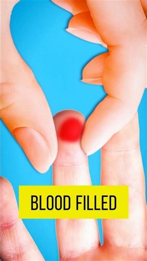 Why Do We Get Blood Blisters !