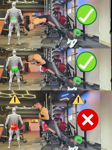 Hyperextension – KNOW THE DIFFERENCE!