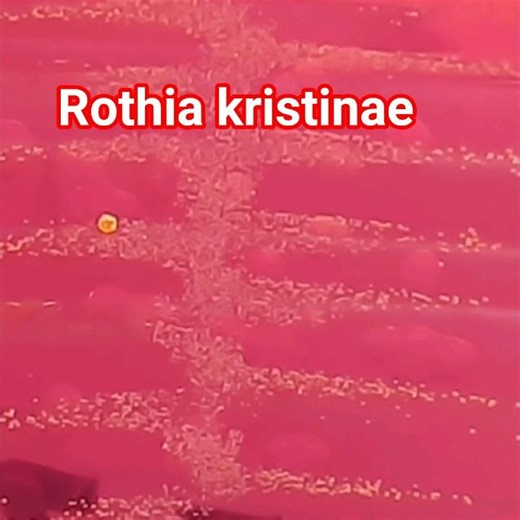Rothia kristinae colony morphology and Gram staining #shorts