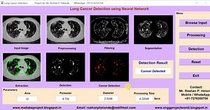 Lung Cancer Detection using Neural Network Matlab Project Source Code