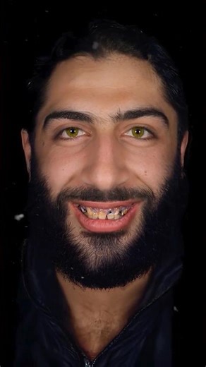 Motion dental design After Effects course