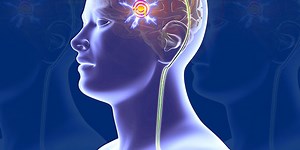 Treating Depression With Deep Brain Stimulation Works—Most of the Time