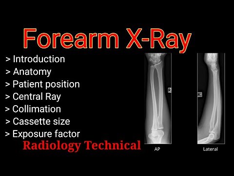 Forearm X-Ray Position # Forearm Ap & lateral View # By BL Kumawat #