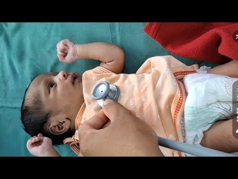 Neonatal examination nicu #premature, IUGR baby. Cleft lip baby.