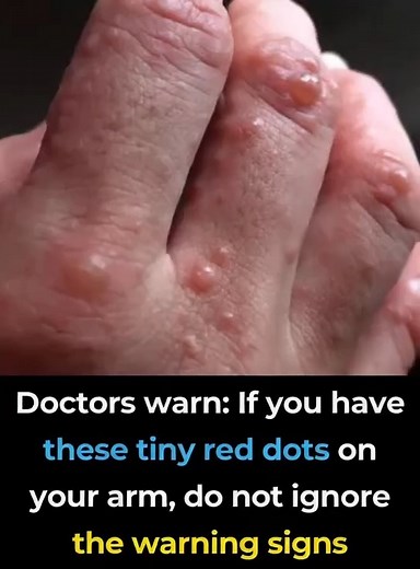 Doctors warn: if you have these tiny red dots on your arm or hand, do not ignore the warning signs 🚨 | Feedy