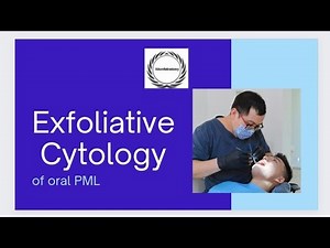 Oral Exfoliative Cytology Of Potentially Malignant Lesion