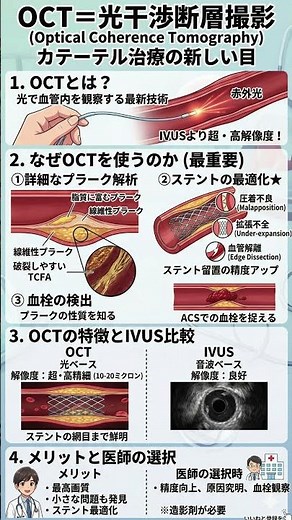 血管内を見る「最強の目」OCTをマスターせよ！ステントトラブルを防ぐ超高解像度イメージングの正体｜心筋梗塞を防ぐ精密診断の科学