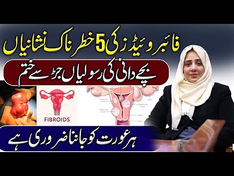 Fibroids Explained: Dangerous Symptoms & Non-Surgical Solutions for Women’s Health 💊 | Surgery-Free
