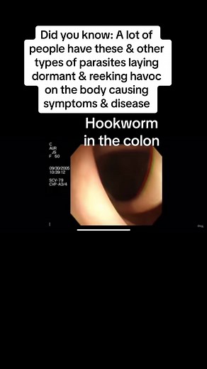 7.4K views · 63 reactions | Perhaps it’s time for a cleanse?? Maybe two lol I have a free detox protocol that will help get rid of parasites from start to finish. #parasite #detox #cleanse #guthealth #worms #chronicillness #chronicdisease #ibs #chronesdisease #mentalhealth #holistichealth #fyp | Quantum Body Healing & Regeneration | Facebook