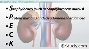 Infectious Causes of Kidney Disease