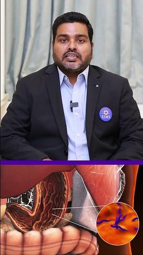 Understanding Intestinal Perforation: Symptoms & Emergency Medical Care | SIMS Hospital
