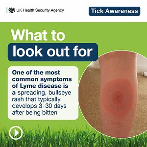 🪲 What to do if you’ve been bitten by a tick Here’s a simple guide to removing a tick effectively, symptoms of Lyme Disease and what to do if you become unwell 👇 🔸 Remove ticks as soon as possible using a tick removal device or a pair of fine-tipped tweezers. 🔹 Grasp the tick as close to the skin as you can and pull upwards firmly, making sure all of the tick is removed. 🔸 Clean the bite area with soap and water and keep an eye on it for a few weeks in case of any changes. 🔹 One of the mos