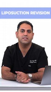 What is liposuction revision?